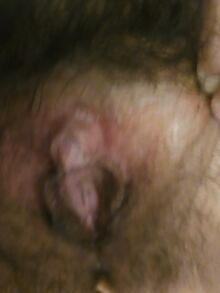 Lutkamainen nainen antaa lähikuvan karvaisesta pillustaan