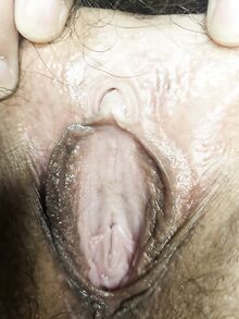 Lutkamainen nainen antaa lähikuvan karvaisesta pillustaan